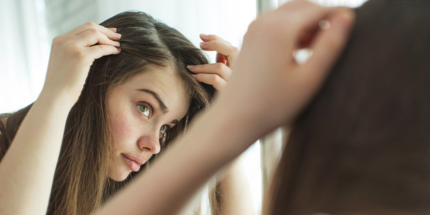 7 Faktor Penyebab  Rambut  Berketombe dan 10 Cara Alami  
